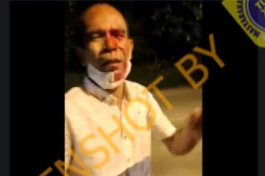 cek-fakta-hoaks-video-pria-jadi-korban-penusukan-pena-di-mata